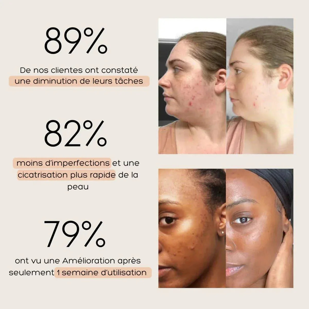 Pads Nettoyants  Acide Kojique & Curcuma