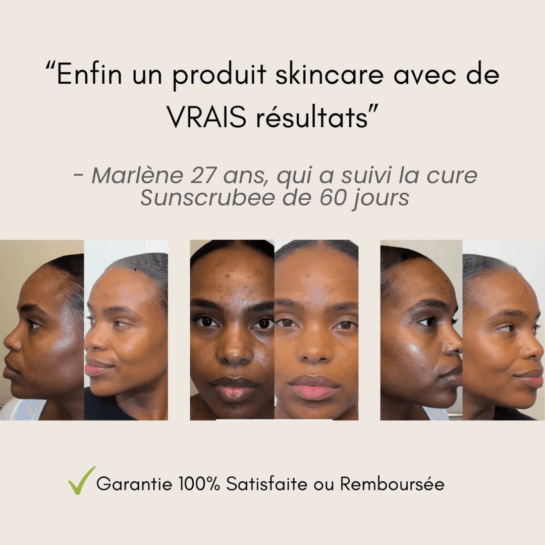 Pads Nettoyants  Acide Kojique & Curcuma